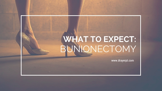 what to expect after bunionectomy