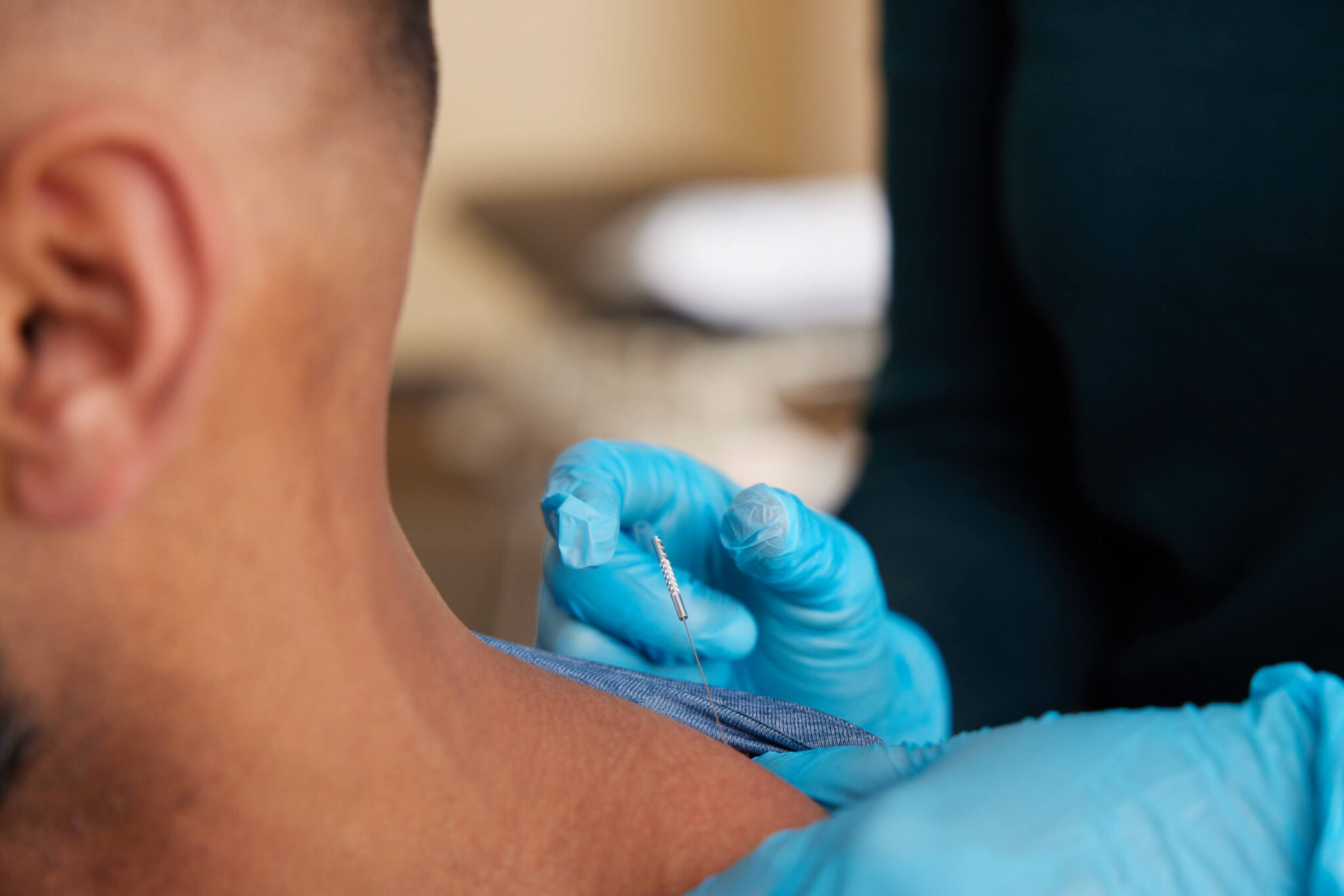 How Dry Needling Works BenchMark Physical Therapy